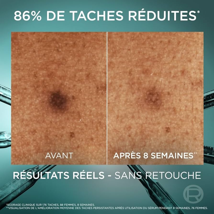 L’ORÉAL PARIS BRIGHT REVEAL NIACINAMIDE 10% SERUM ANTI TACHES 30 ML
