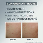 GARNIER AIR CREAM SOIN MATIFIANT QUOTIDIEN AHA+BHA 50ML