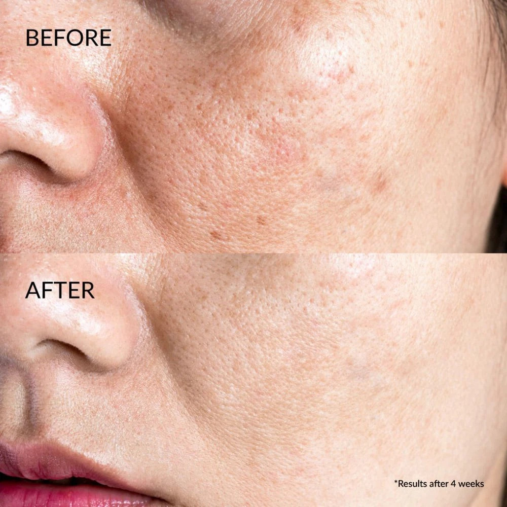 IREN SHIZEN SÉRUM ÉCLAIRCISSANT TRÈS PERFORMANT