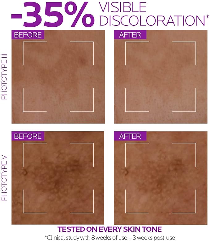 LA ROCHE POSAY PURE NIACINAMIDE 10 SERUM 30ML