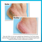 O'KEEFFE'S HEALTHY FEET CRÈME POUR LES PIEDS 91 G