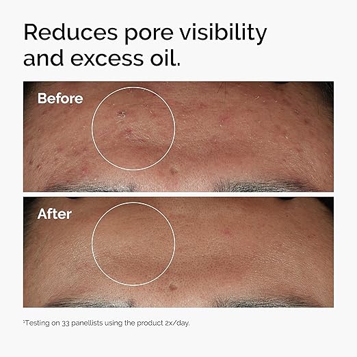 THE ORDINARY NIACINAMIDE 10% + ZINK 1% 30ML