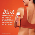 BIO-OIL SPECIALIST SKIN CARE OIL - SCARS, STRETCH MARK PRODUCT