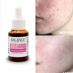 BALANCE ACTIVE FORMULA AHA 10 BHA 2 RESURFACE & BRIGHTEN SERUM 30ML