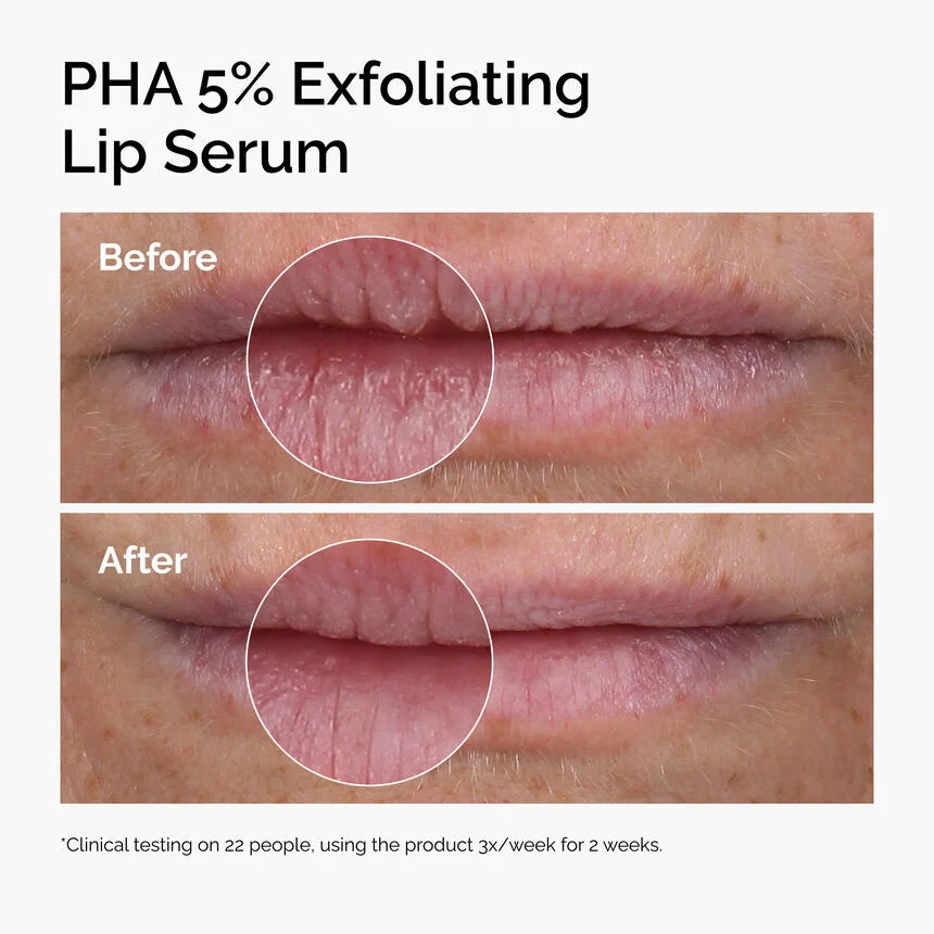 THE ORDINARY LHA 5% EXFOLIATING LIP SERUM 15ML