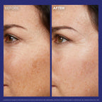 L’ORÉAL PARIS REVITALIFT LASER SERUM NUIT 0.2% RETINOL PUR 30ML