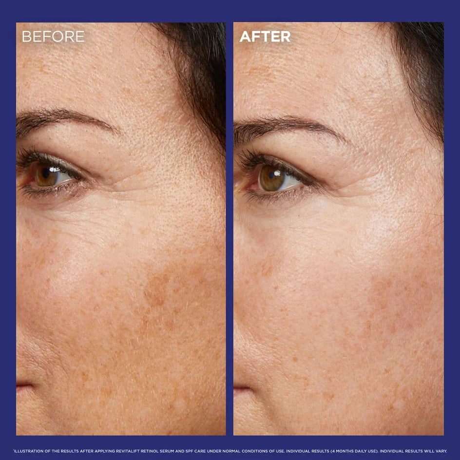 L’ORÉAL PARIS REVITALIFT LASER SERUM NUIT 0.2% RETINOL PUR 30ML