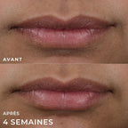ROC DERM CORRECTION LIP VOLUMIZER REPLUMPING TREATMENT  10ML
