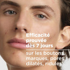 BIODERMA SÉBIUM SERUM CONCENTRÉ LISSANT ANTI-IMPERFECTIONS 30ML