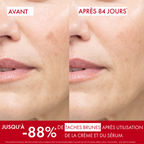 VICHY LIFTACTIV B3 SERUM ANTI-RIDES & ANTI-TACHES 30ML