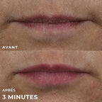 ROC DERM CORRECTION LIP VOLUMIZER REPLUMPING TREATMENT  10ML